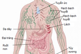 HẠCH BẠCH HUYẾT VÀ UNG THƯ